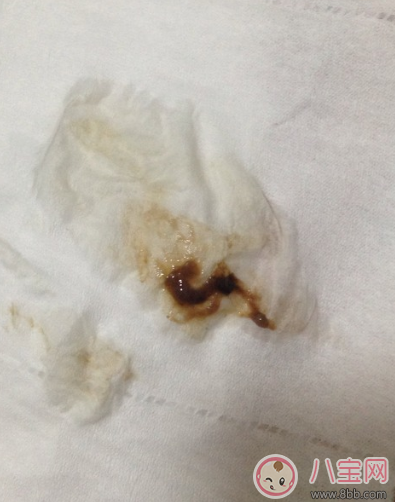 怀孕褐色分泌物是男孩 怀孕初期有褐色分泌物流出是男孩吗 怀孕褐色分泌物是男孩 怀孕初期有褐色分泌物流出是男孩吗
