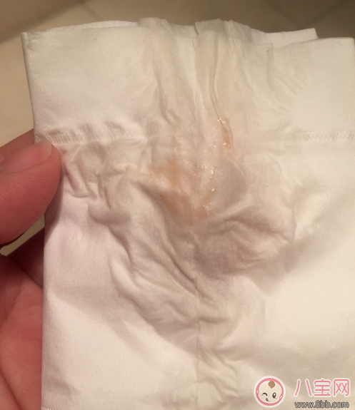 怀孕褐色分泌物是男孩 怀孕初期有褐色分泌物流出是男孩吗 怀孕褐色分泌物是男孩 怀孕初期有褐色分泌物流出是男孩吗